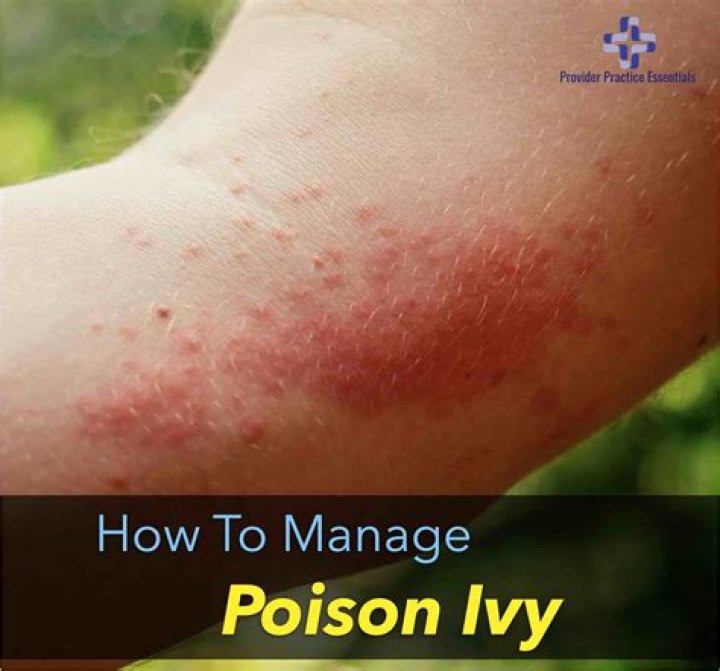 Does poison go away over time or do I have to cure it?