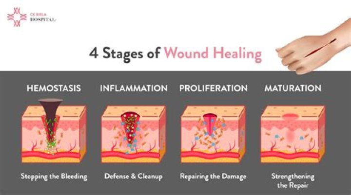 How do I heal without potions?