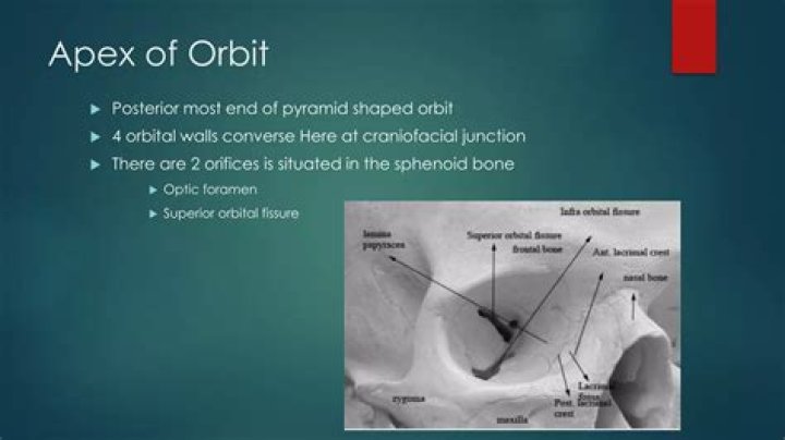 Shortest path to the apex of a cone