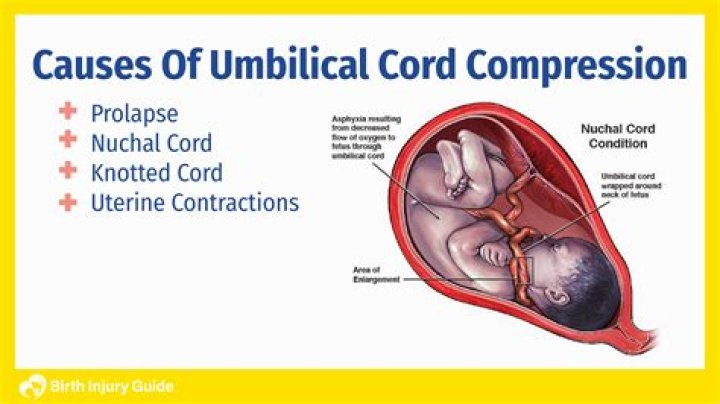 When is the latest I can consume the Umbilical Cords?